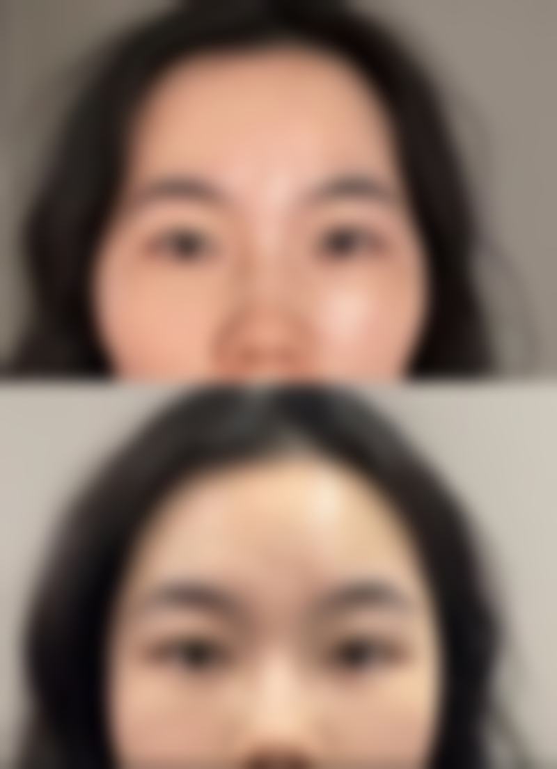 朱远飞医生真实实例