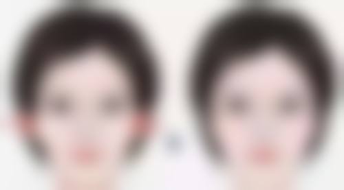 林幸道医生技术特点