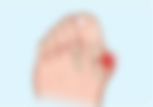 陈建光医生技术特点