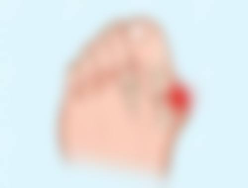 崔贵东医生真实实例
