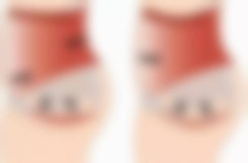 天天用黄瓜贴眼袋适合吗