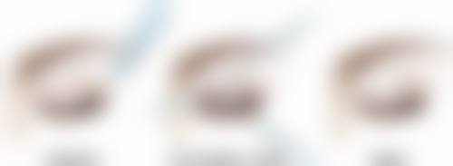 倪建阁医生技术特点