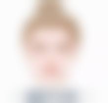 割双眼皮出血多适合做吗