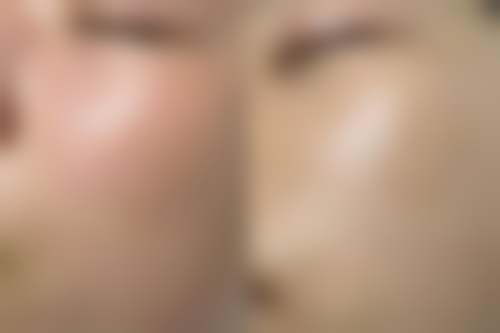 韩国SU i 整形外科真实实例