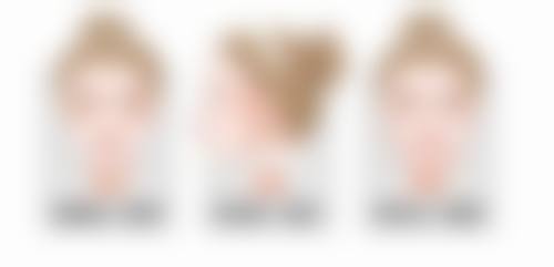 微针修复治疗疤痕性青春痘适合吗?