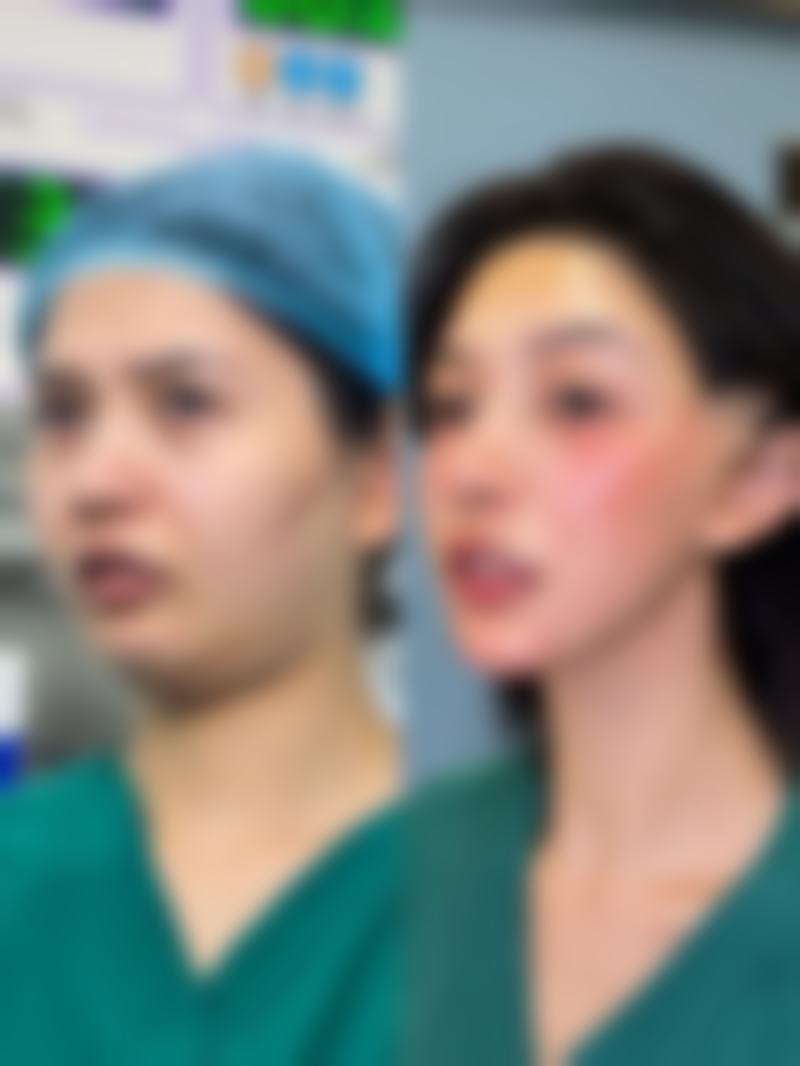 大腿吸脂修复后多久能看到成效