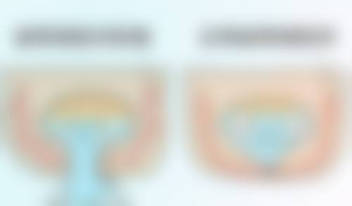 隆胸对身体危害大吗？专业解析：正规隆胸危害可控，选对方式让你美而无忧！ 
