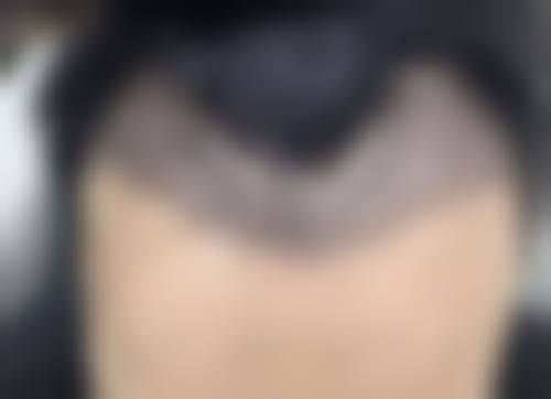 肿 瘤外科石磊医生技术特点