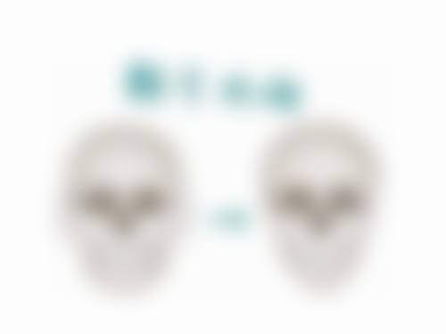 四个半月修复全切双眼皮靠谱吗