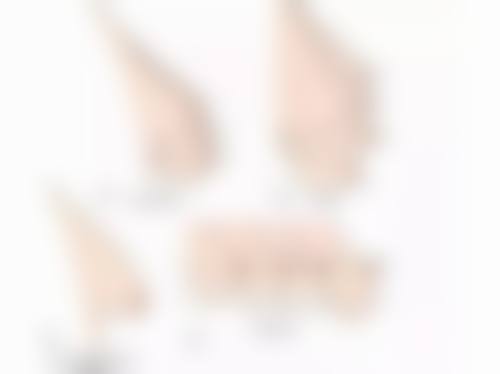 绵阳艾美齿科门诊部口碑怎么样:患者真实评价见证