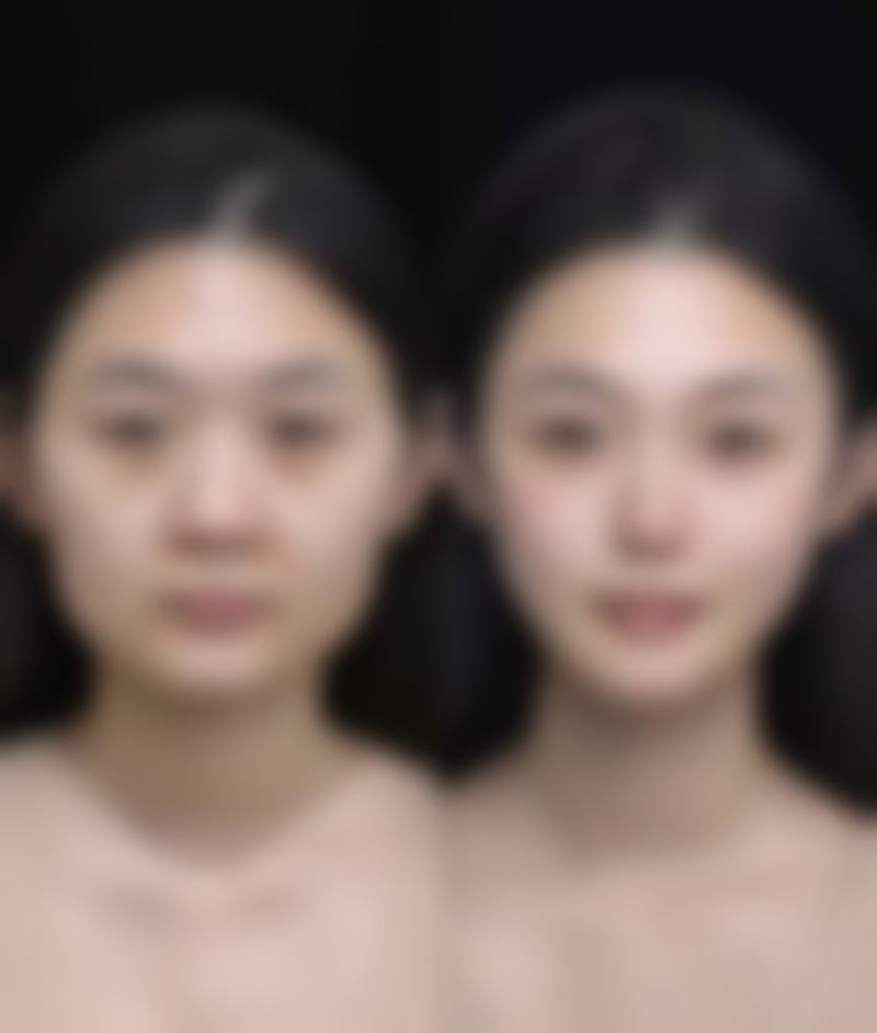 阜阳斯尔美千悦医疗美容门诊部价格表