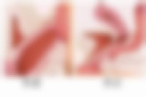 影响超声法去眼袋价格的因素有哪些?