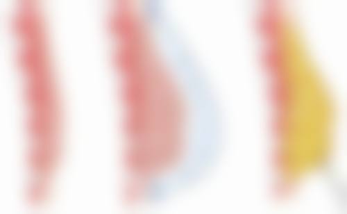 超声法去眼袋3800元值不值?