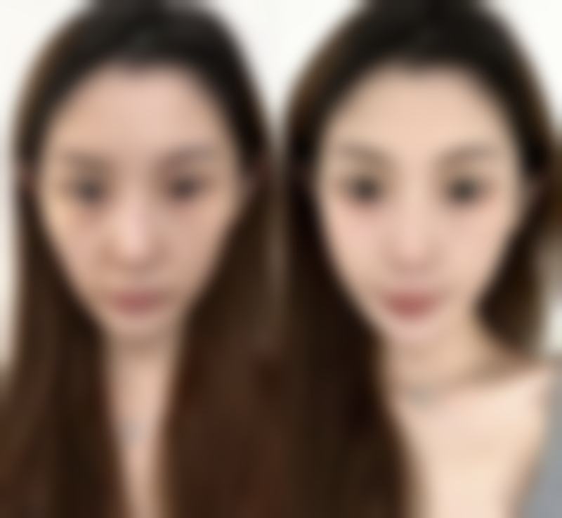 姜亮守医生真实实例