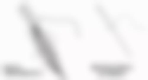 切开双眼皮3 - 6个月完全修复适合所有人吗