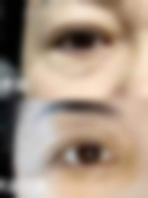 阜阳黛莱美医疗美容医院擅长项目怎么样
