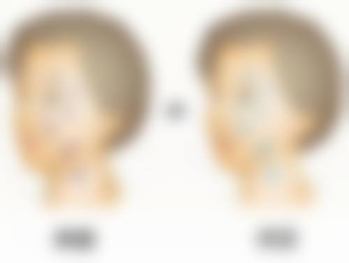 李静宜医生技术特点