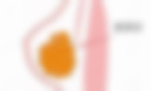 惠雷医生怎么预约挂号:轻松便捷不麻烦