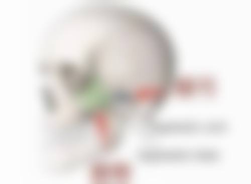 大腿吸脂一个月没细需要再次手术吗
