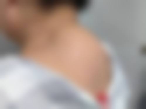 烟台木蓝整形医院仪器设备:精良科技助力美丽