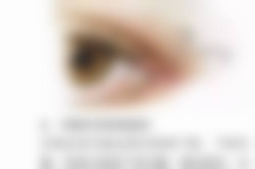 割眼袋后如何降低风险