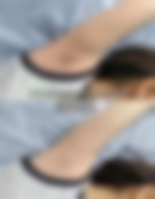 漳州解放军第175医院烧伤整形科擅长项目