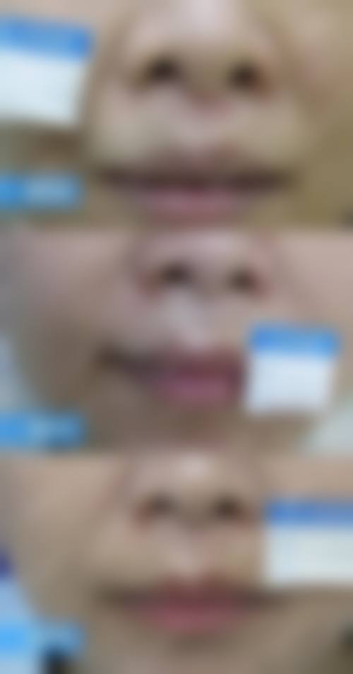 深圳氧颜蔻医疗美容诊所口碑怎么样