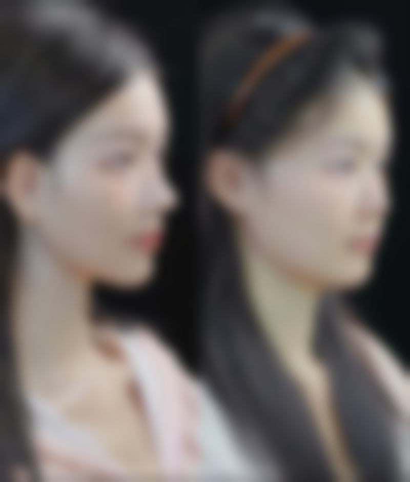 登封现代美学整形医院价格表:合理透明性价比高