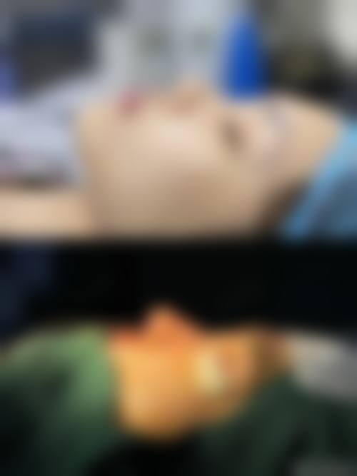 韩国 Yenergy 整形医院价格表