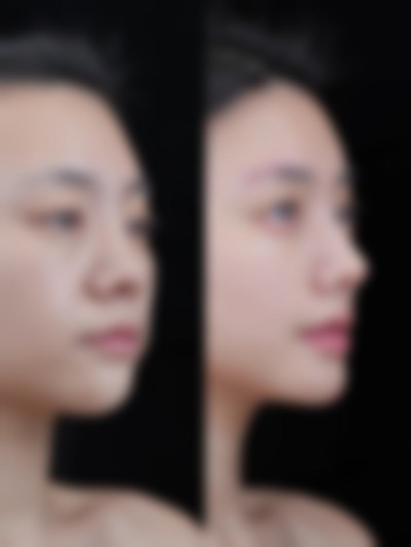 韩国 Yenergy 整形医院擅长项目
