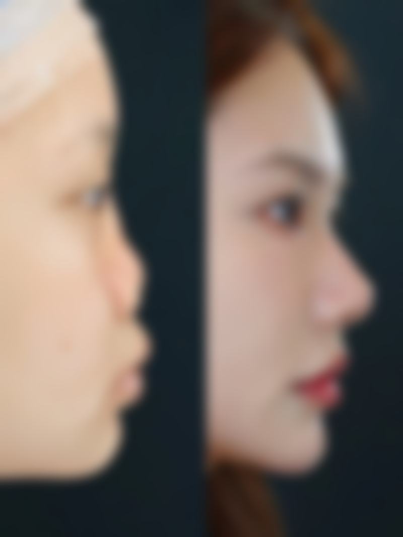 韩国LeeYoung整形外科营业时间:贴心安排等你美