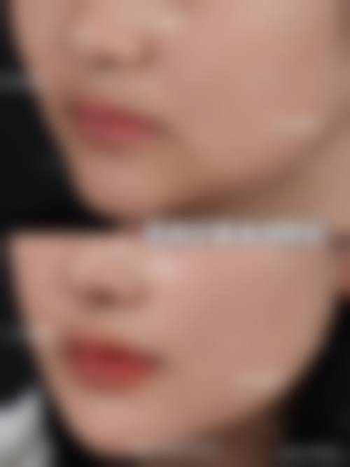 南京素丽整形医院真实实例:见证美丽的蜕变