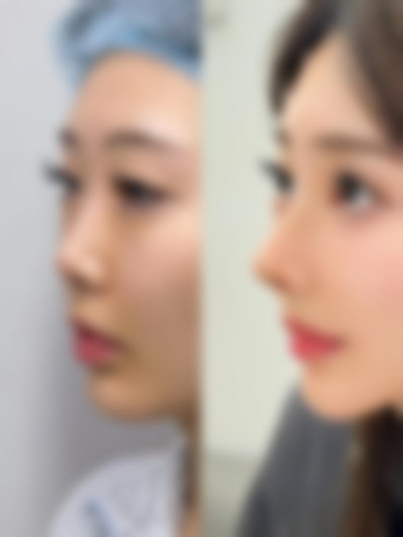 北京馨月整形医院擅长项目:解锁多样美丽密码