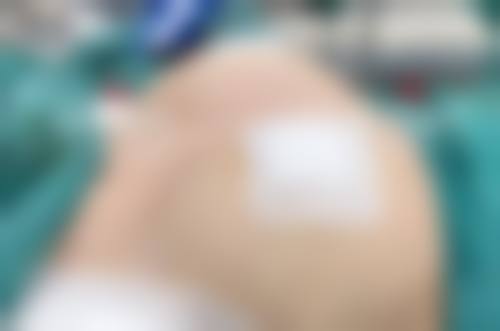 李智善的就诊体验与服务流程:打造极致舒适的医美之旅