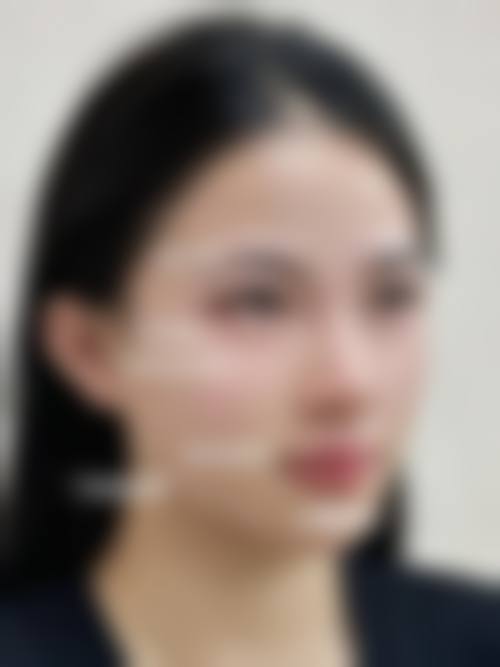 总结:李智善——重新定义舒适化整形的行业标杆