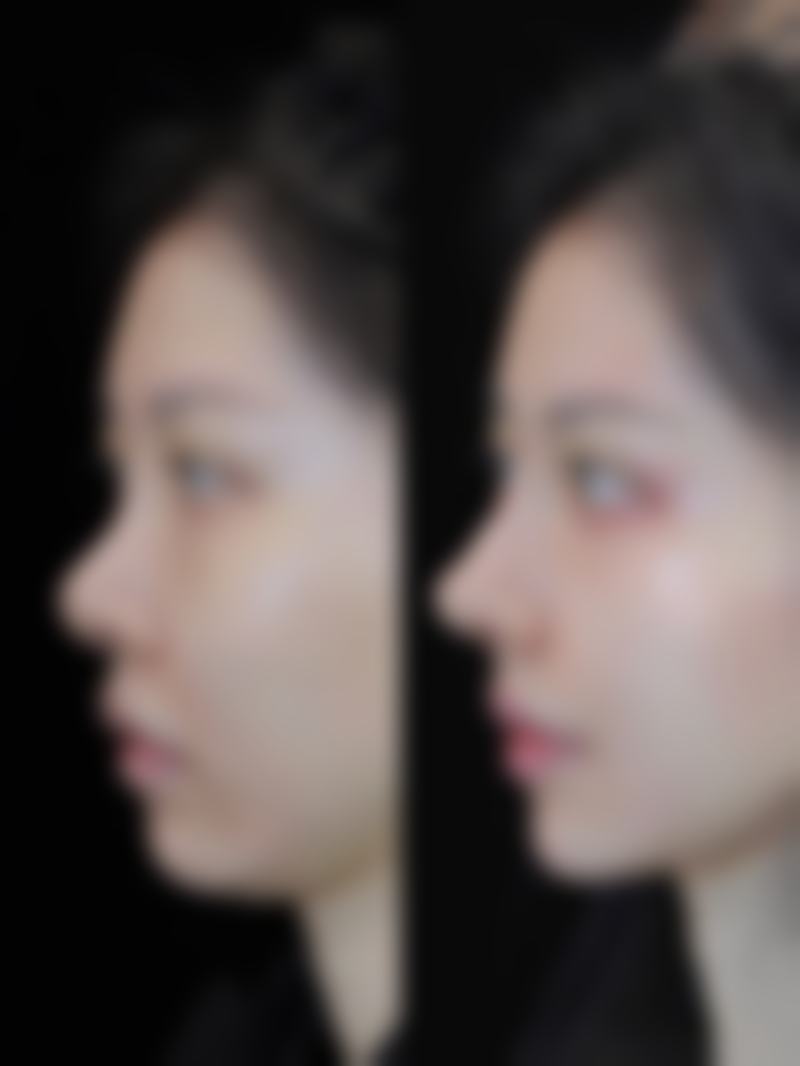 如何预约金钟渊面诊及避坑指南