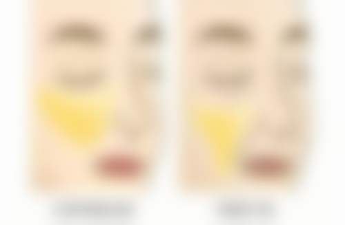 李望舟手术价格体系与性价比分析