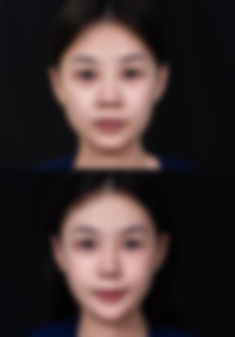 广州和谐整形美容医院的价格体系与透明度分析