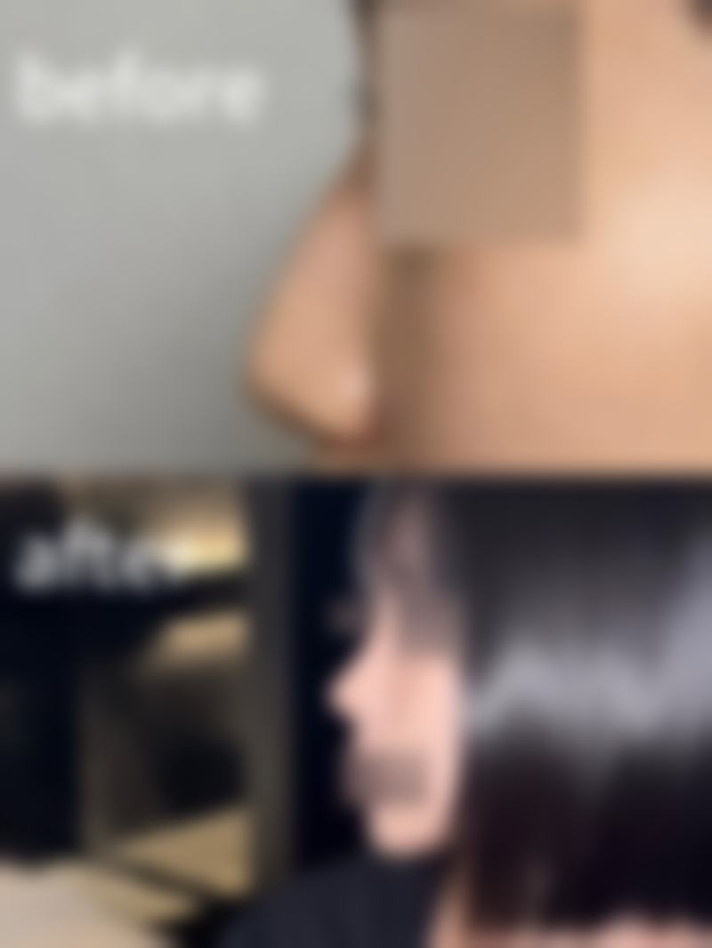 林琳的价格体系与就诊指南