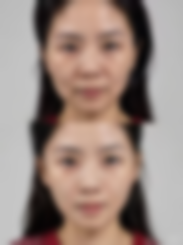 朴俸材的技术优势与“解剖级”治疗体系