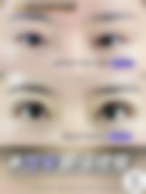 涿州明日昔颜整形医院预约指南与常见问题解答