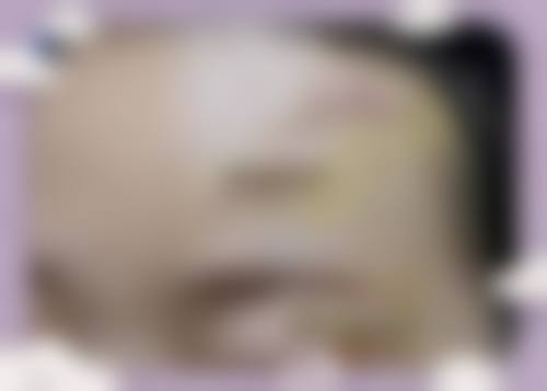北京红旗中医院植发科的真实实例分享与用户口碑见证
