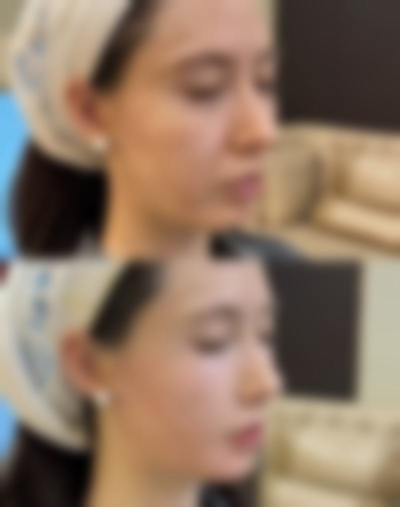 术后护理与长期维护的关键策略