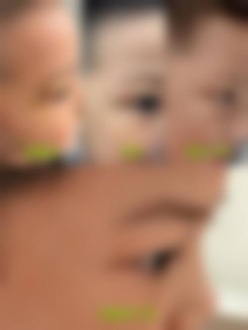 真实实例分享与患者口碑反馈
