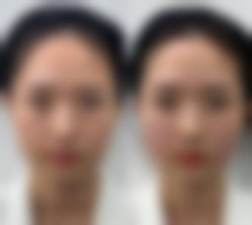 福州第一医院整形美容中 心就医指南与预约注意事项