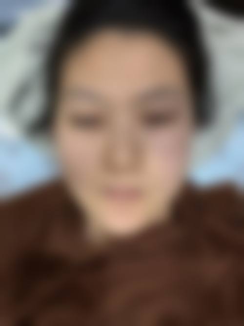 福州第一医院整形美容中 心真实实例分享与用户口碑评价