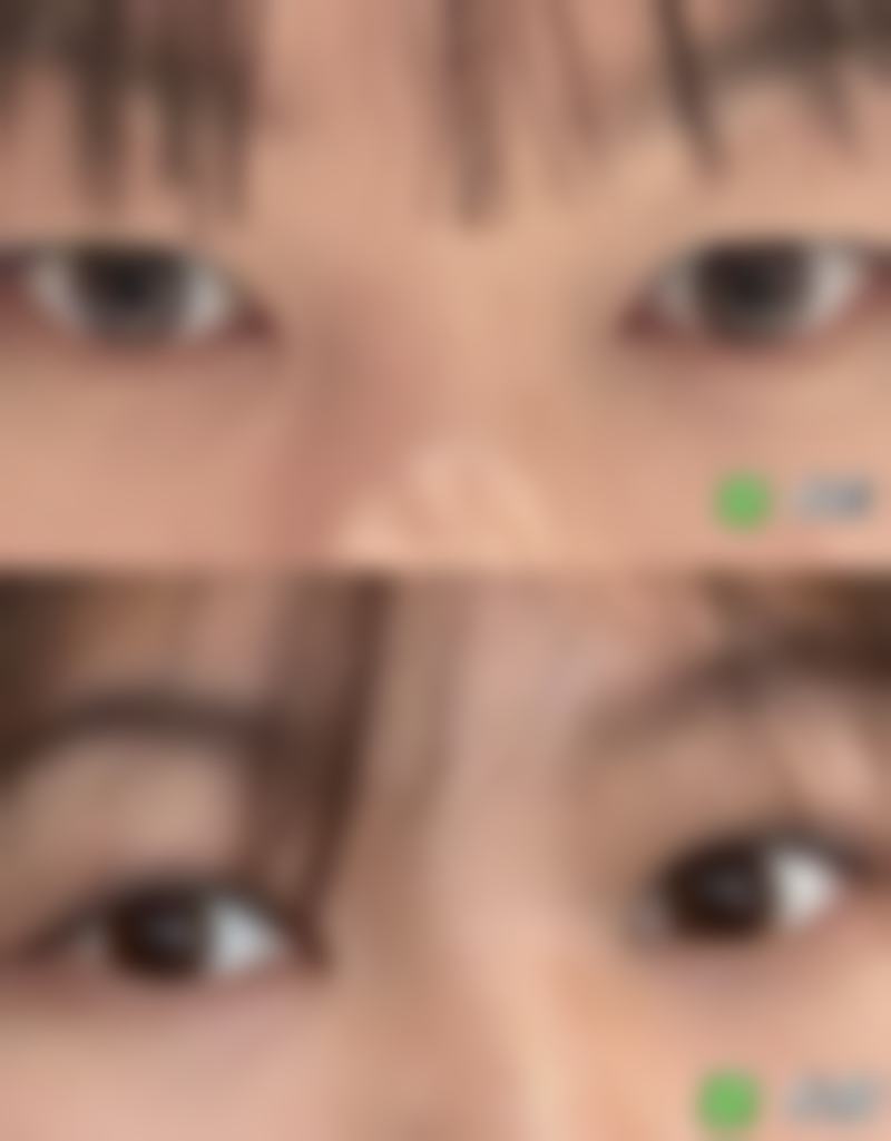 总结:辛时林——值得托付的专精整形骨干医生