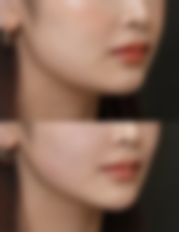 疤痕消退期变粉色正常吗?2026医美口腔眼科骨干医生揭秘,教你科学应对不焦虑