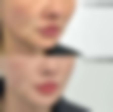马芸医生热门项目详解与适用人群分析