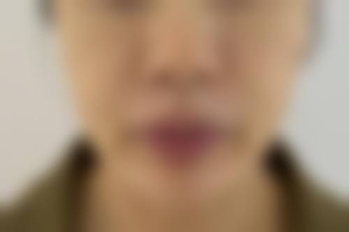 金容主擅长的手术类型与安心麻醉策略